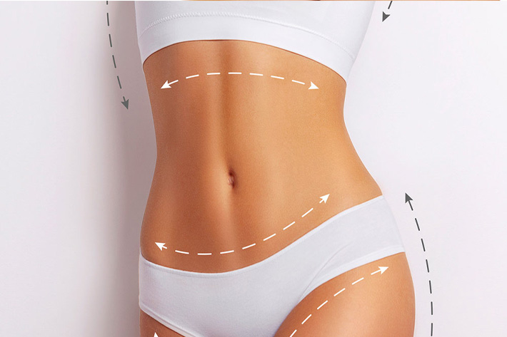 Abdominoplastie