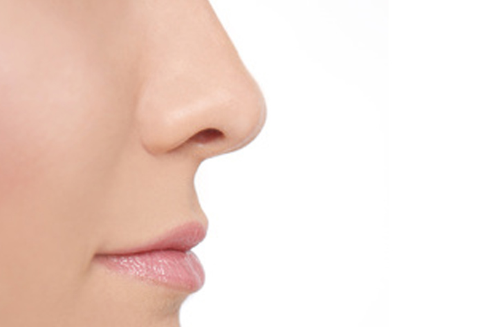 Rhinoplastie